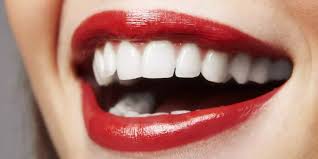 Cuidados de tus implantes dentales
